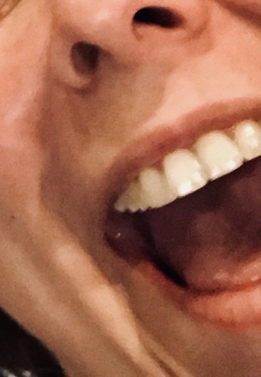 close up of mouth laughing