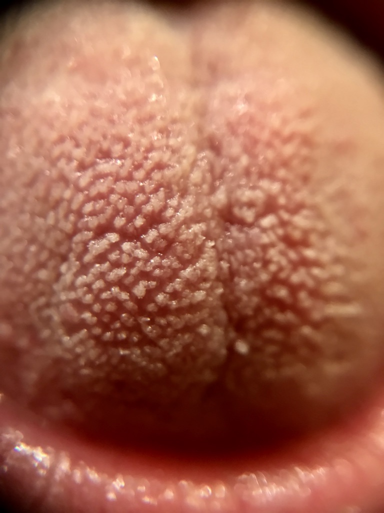 Close up of a tongue and it's taste buds